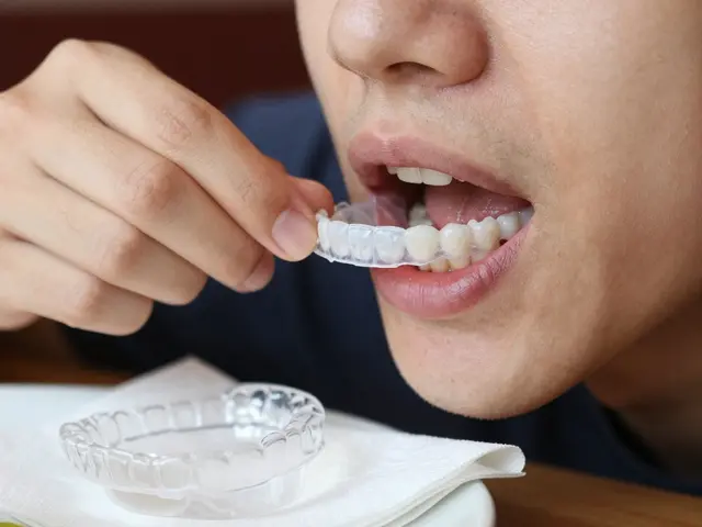 Jak často nosit retencní rovnátka? Praktický průvodce pro po zubních rovnátkách