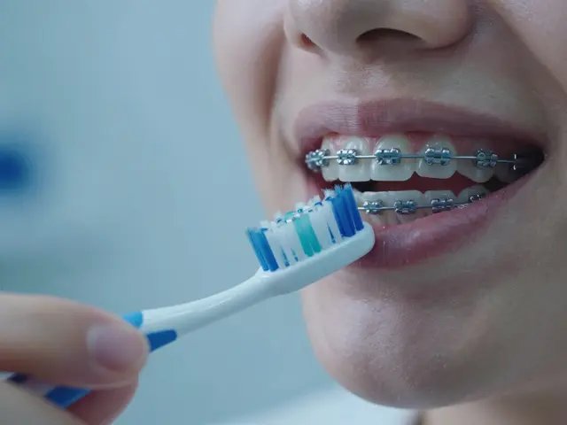 Jak na údržbu fixních rovnátek: Praktický průvodce pro zdravé zuby