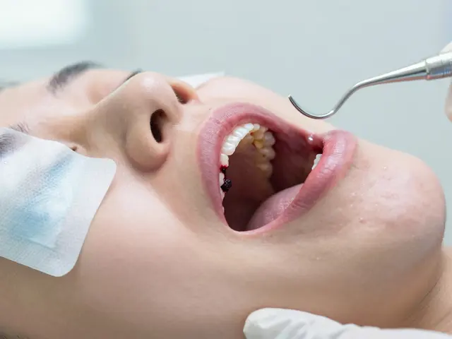 Kdy se zatahne rána po extrakci zubu? Co očekávat a kdy se obrátit na zubaře