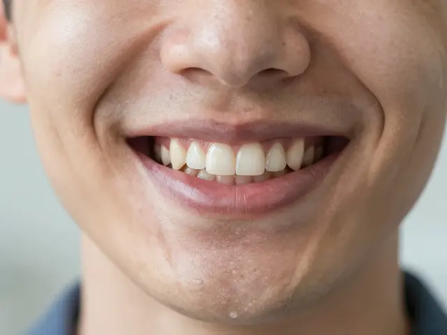 Veneery zuby: Jaké jsou skutečné alternativy k estetickému zubnímu obložení?