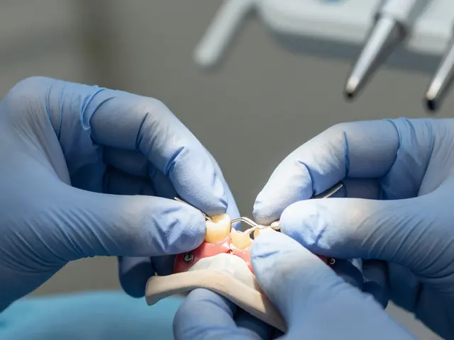 Jak dlouho vydrží můstek na zubech - skutečná doba trvání a co na to ovlivňuje