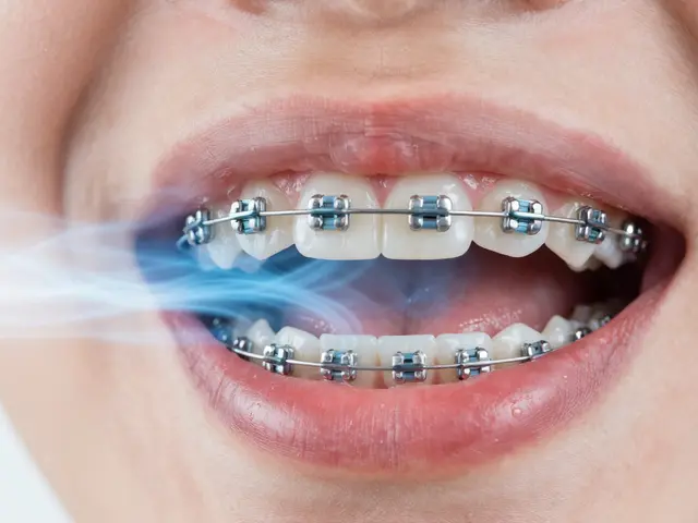 Jak rovnátka ovlivňuje dýchání a co s tím dělat