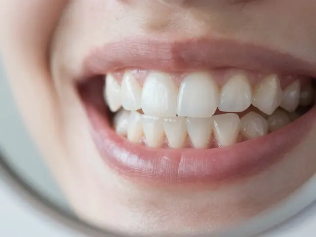 Praskliny na zubech: Jak jim předcházet a co dělat, když už jsou tady