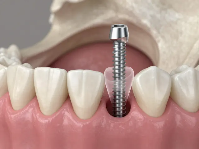 Kdy se dává implantát po vytržení zubu? Kompletní průvodce načasováním